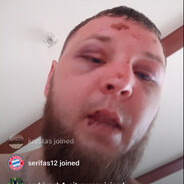 Dainius, pasodintas uz neka